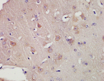 KCNC3 Rabbit Polyclonal Antibo