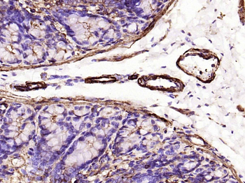 Alpha smooth muscle Actin Reco