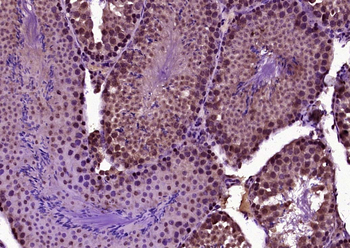 BNC1 Rabbit Polyclonal Antibod