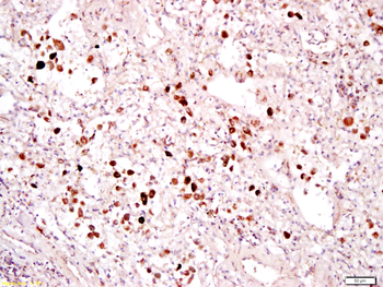 Phospho-RAF1 (Ser43) Rabbit Po