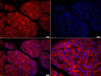 Amphiregulin Rabbit Polyclonal
