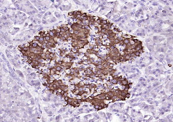 HDHD3 Rabbit Polyclonal Antibo