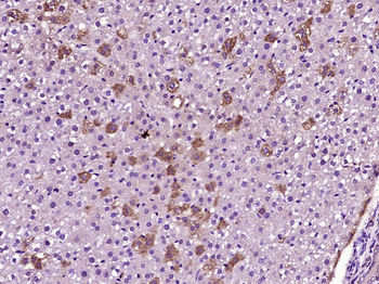 ACOX2 Rabbit Polyclonal Antibo