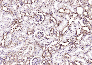 Calreticulin Mouse Monoclonal