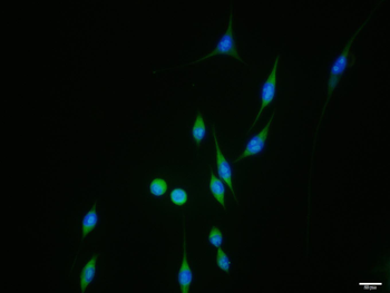 Phospho-RPS6KB1 (Ser417) Rabbi