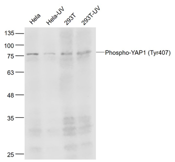 Phospho-YAP1 (Tyr407) Rabbit P