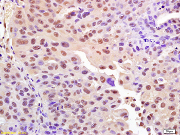 Phospho-H2AX (Ser139) Rabbit P