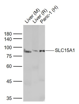SLC15A1 Rabbit Polyclonal Anti