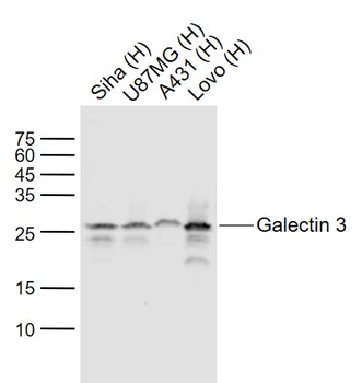 Galectin 3 Mouse Monoclonal An