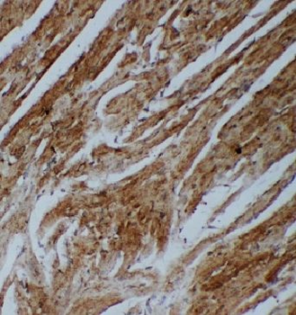 ANGPT2 Antibody抗体,orb624697,bi