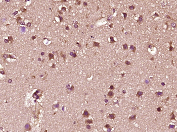 C-fos Rabbit Polyclonal Antibo