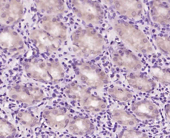 BNC1 Rabbit Polyclonal Antibod