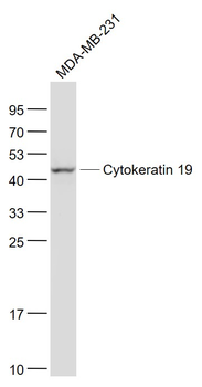 Cytokeratin 19 Recombinant Rab