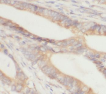 CES3 Antibody抗体，orb625734，bior