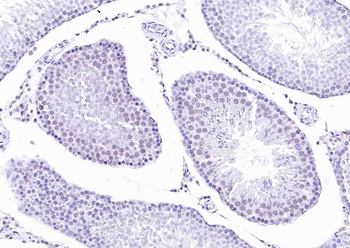 BRCA2 Rabbit Polyclonal Antibo