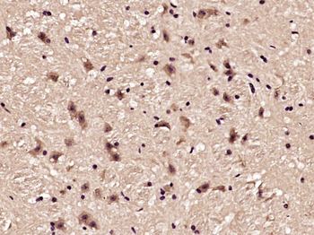 Phospho-Akt (Thr450) Rabbit Po