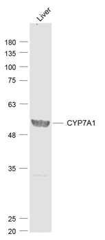 CYP7A1 Rabbit Polyclonal Antib