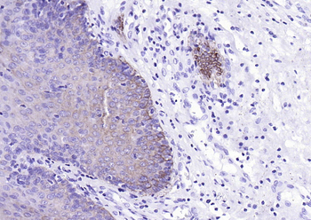 Cytokeratin 4 Recombinant Rabb