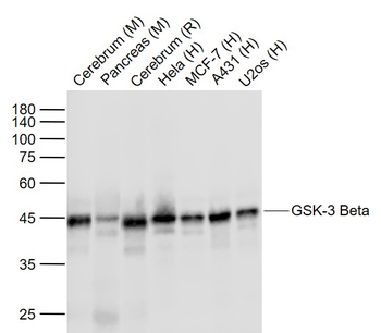 GSK-3 Beta Mouse Monoclonal An