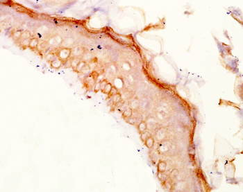 TYRP1 Rabbit Polyclonal Antibo