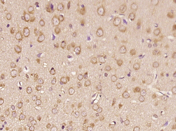 RNF170 Rabbit Polyclonal Antib
