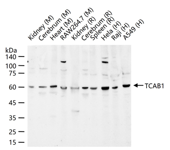 TCAB1 Rabbit Polyclonal Antibo