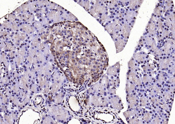LSM3 Rabbit Polyclonal Antibod