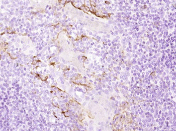 Cytokeratin 19 Recombinant Rab