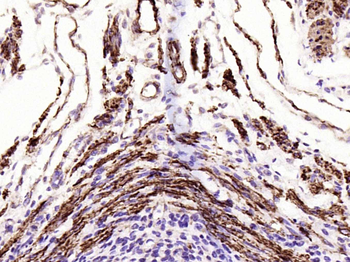 Alpha smooth muscle Actin Reco