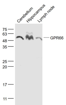 NMUR1/GPR66 Rabbit Polyclonal 