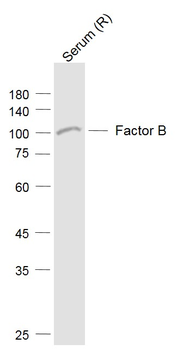 Factor B Rabbit Polyclonal Ant