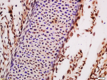 TLK1 Rabbit Polyclonal Antibod