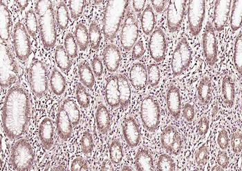 Phospho-Crkl (Tyr251) Rabbit P