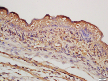 NR5A2 Rabbit Polyclonal Antibo