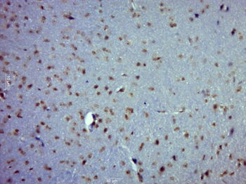 PAG608 Rabbit Polyclonal Antib