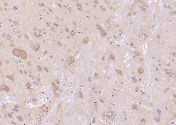 GSK-3 Beta Mouse Monoclonal An