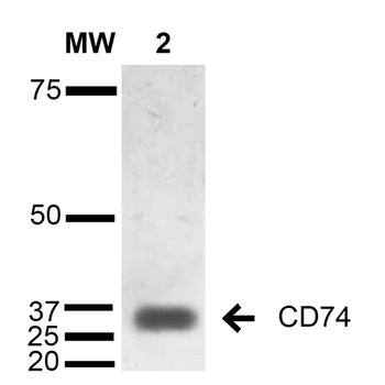CD74 Antibody (FITC)抗体，orb3963