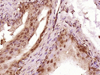 ABCF1 Rabbit Polyclonal Antibo