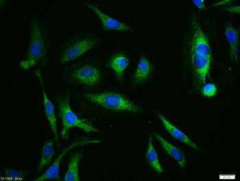 XIAP/BIRC4 Rabbit Polyclonal A