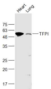 TFPI Rabbit Polyclonal Antibod