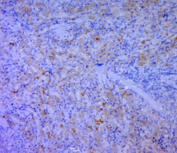 CD5L Rabbit Polyclonal Antibod