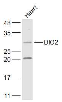 DIO2 Rabbit Polyclonal Antibod