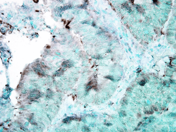 HSP90 Antibody (APC)抗体，orb1473