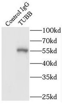 Beta Tubulin Antibody抗体,orb625