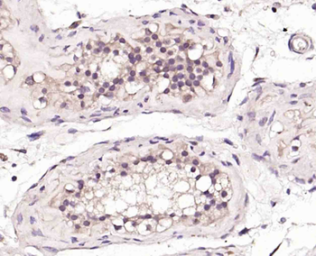 BNC1 Rabbit Polyclonal Antibod