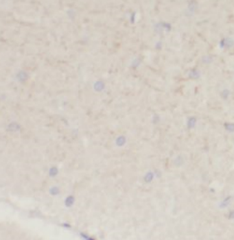 SLC12A5 Antibody抗体，orb395581，b