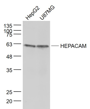 HEPACAM Rabbit Polyclonal Anti