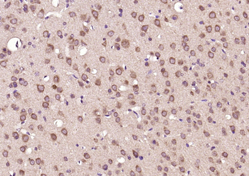 GK5 Rabbit Polyclonal Antibody