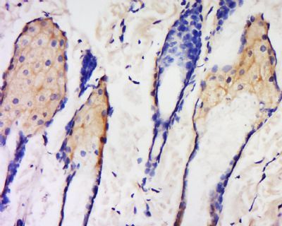 Krt42 Rabbit Polyclonal Antibo