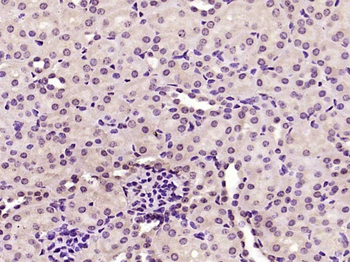 TSEN15/C1orf19 Rabbit Polyclon